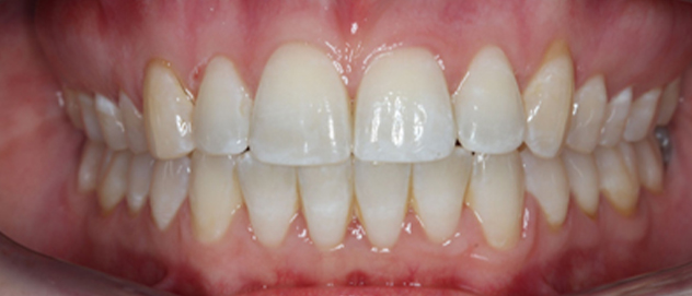 Before & Afters Before & Afters