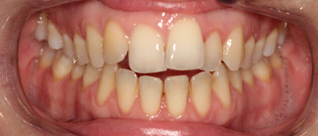 Before & Afters Before & Afters