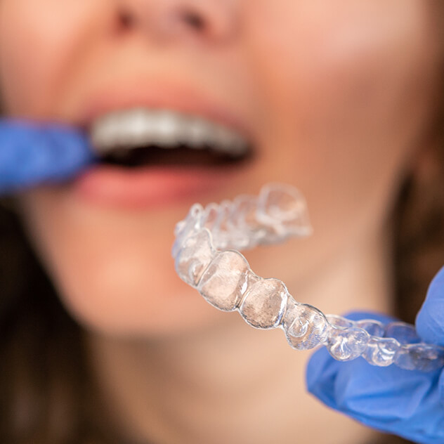 Types of Invisalign®
treatment at The Brace Types of Invisalign®
treatment at The Brace