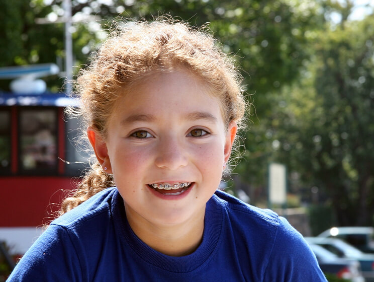 Braces for children Braces for children