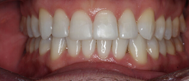 Before & Afters Before & Afters