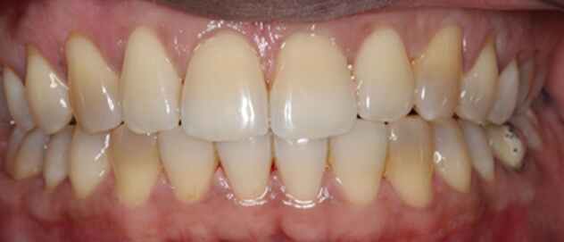 Before & Afters Before & Afters