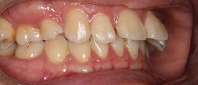 Before & Afters Before & Afters