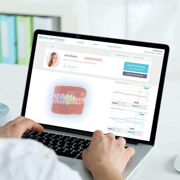 What is Dental Monitoring? What is Dental Monitoring?