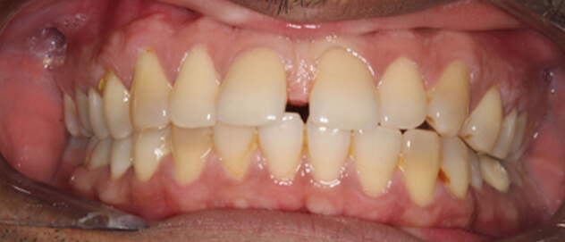 Before & Afters Before & Afters