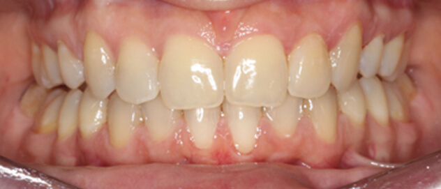 Before & Afters Before & Afters