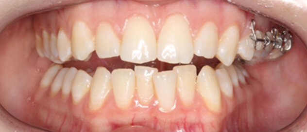 Before & Afters Before & Afters