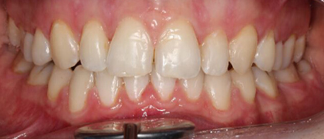 Before & Afters Before & Afters