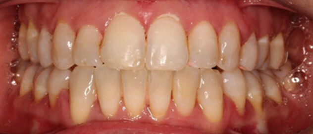 Before & Afters Before & Afters