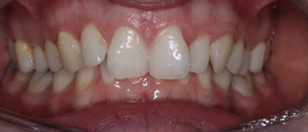 Before & Afters Before & Afters