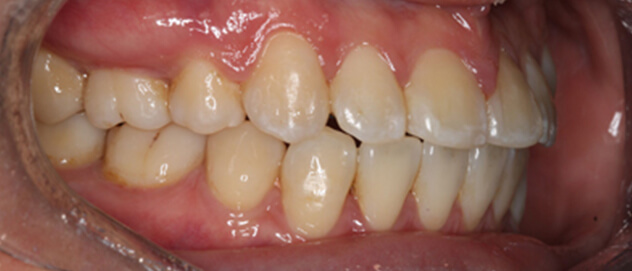 Before & Afters Before & Afters