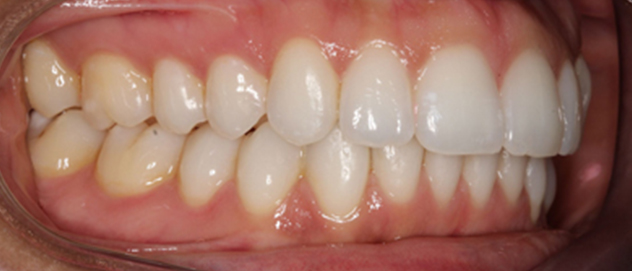 Before & Afters Before & Afters
