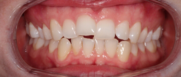 Before & Afters Before & Afters