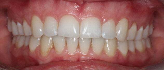 Before & Afters Before & Afters