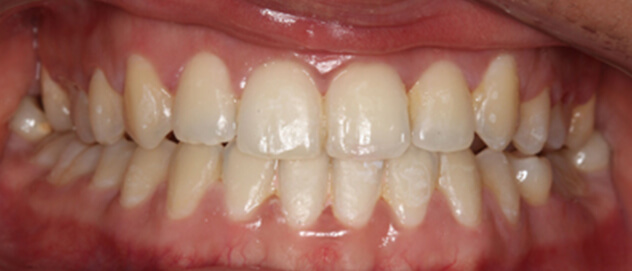 Before & Afters Before & Afters