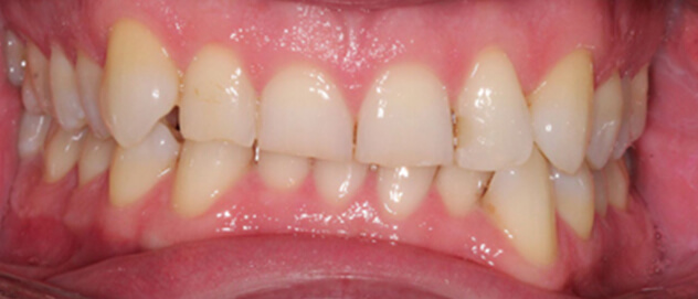 Before & Afters Before & Afters