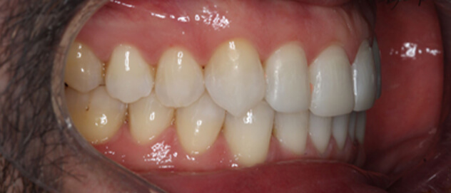Before & Afters Before & Afters