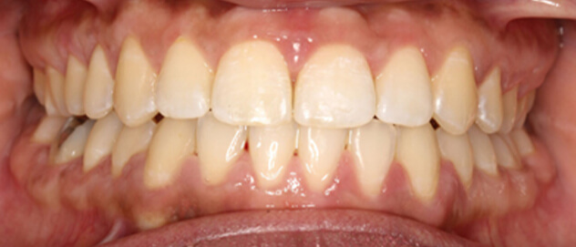 Before & Afters Before & Afters