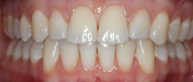 Before & Afters Before & Afters