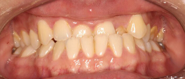 Before & Afters Before & Afters
