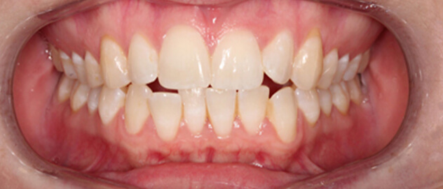 Before & Afters Before & Afters