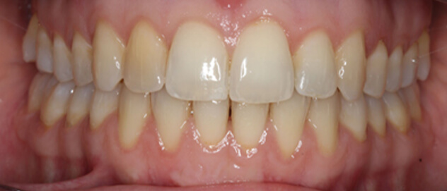 Before & Afters Before & Afters