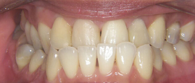 Before & Afters Before & Afters