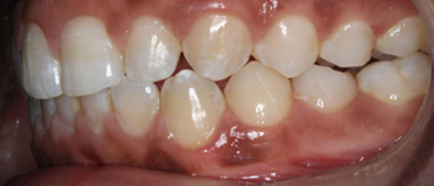 Before & Afters Before & Afters