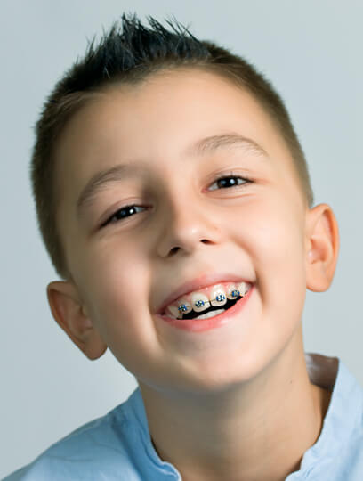 Braces for children