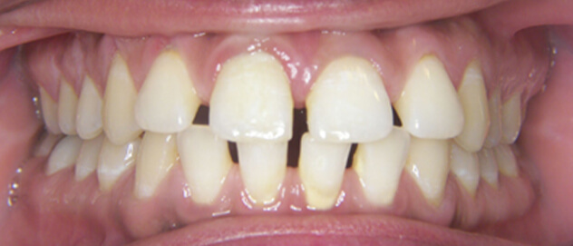 Before & Afters Before & Afters