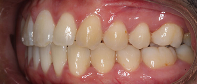 Before & Afters Before & Afters