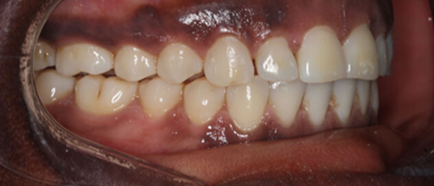 Before & Afters Before & Afters