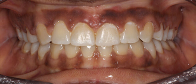 Before & Afters Before & Afters